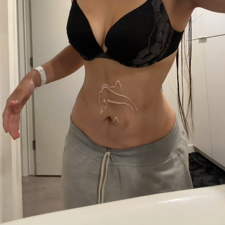 Lines of the light peach cream on a woman's belly, above the belly button, before she rubs it in